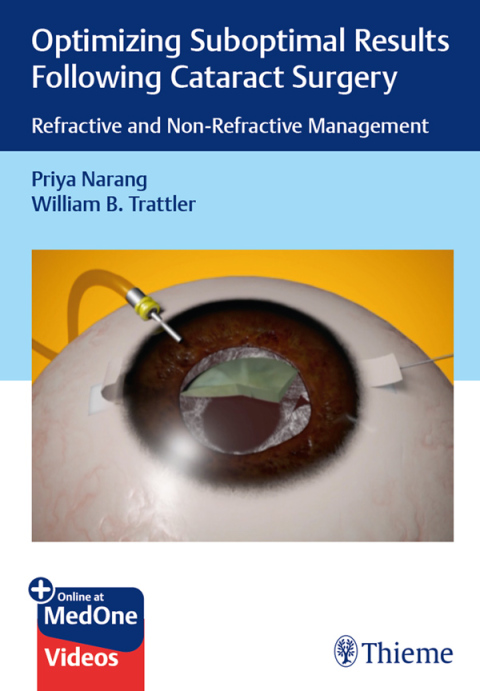 Cover image for book Optimizing Suboptimal Results Following Cataract Surgery