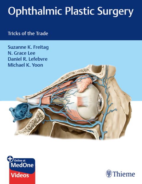 Cover image for book Ophthalmic Plastic Surgery