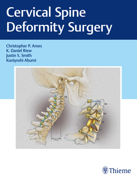Cervical Spine Deformity Surgery 