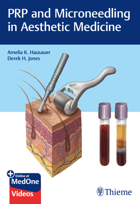 PRP and Microneedling in Aesthetic Medicine 