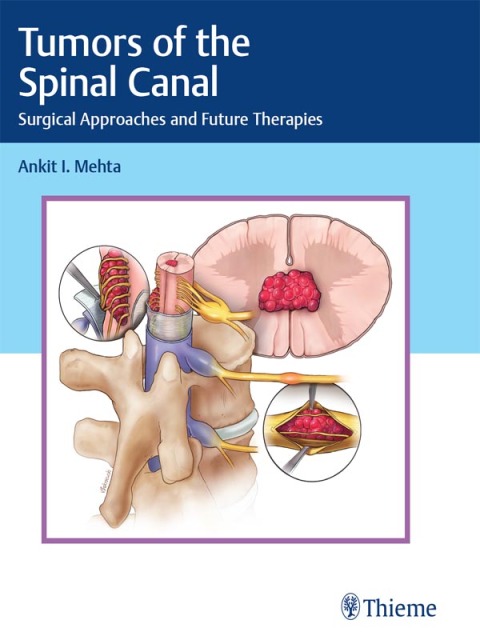 Cover image for book Tumors of the Spinal Canal