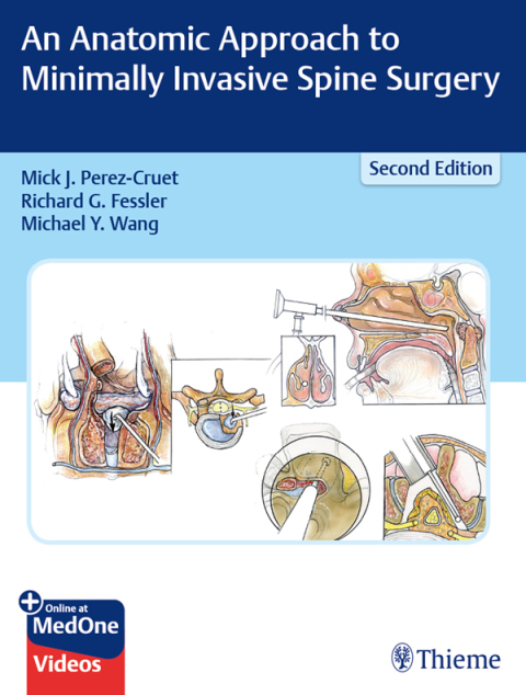 An Anatomic Approach to Minimally Invasive Spine Surgery 