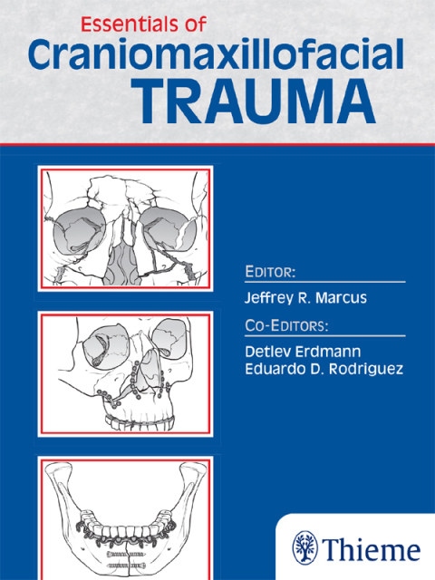 Cover image for book Essentials of Craniomaxillofacial Trauma