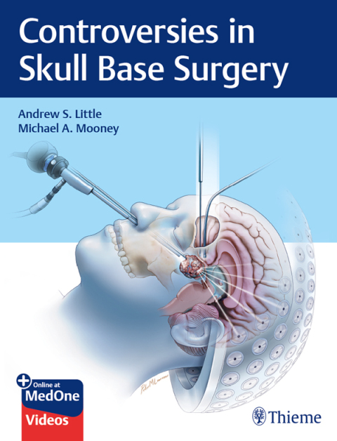 Cover image for book Controversies in Skull Base Surgery