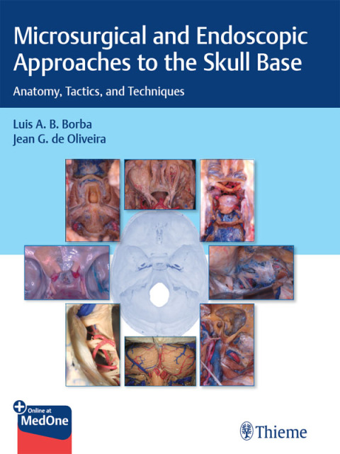 Cover image for book Microsurgical and Endoscopic Approaches to the Skull Base