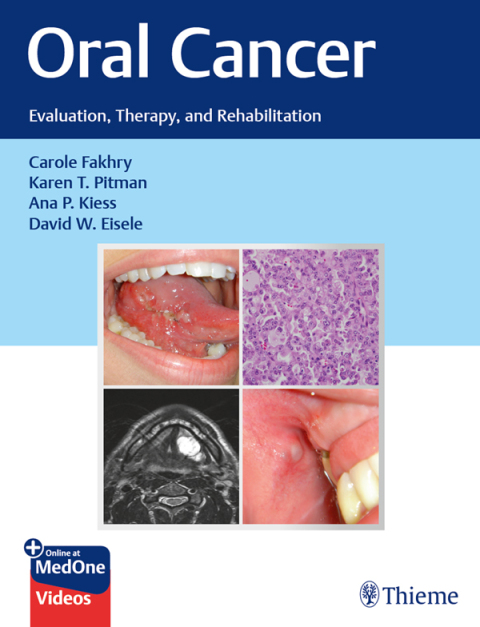 Cover image for book Oral Cancer
