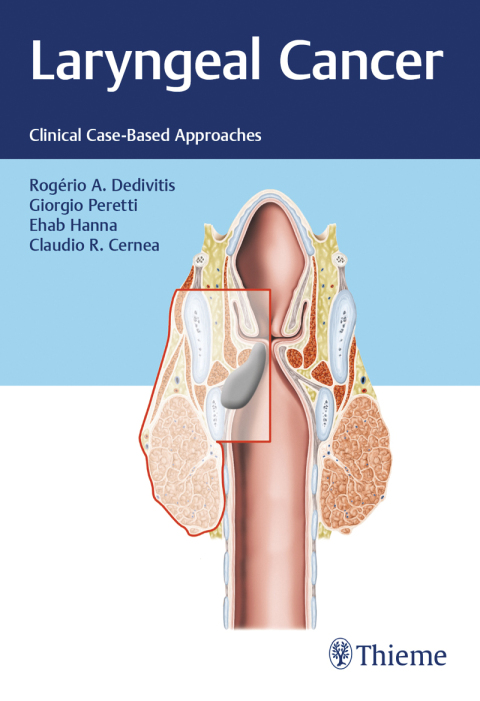 Cover image for book Laryngeal Cancer