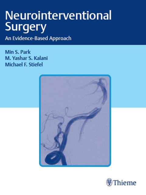 Cover image for book Neurointerventional Surgery