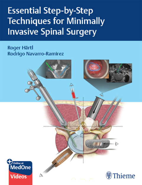 Essential Step-by-Step Techniques for Minimally Invasive Spinal Surgery 