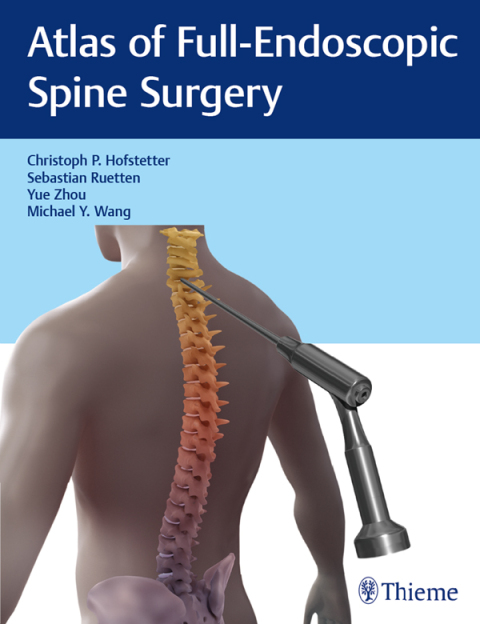 Cover image for book Atlas of Full-Endoscopic Spine Surgery