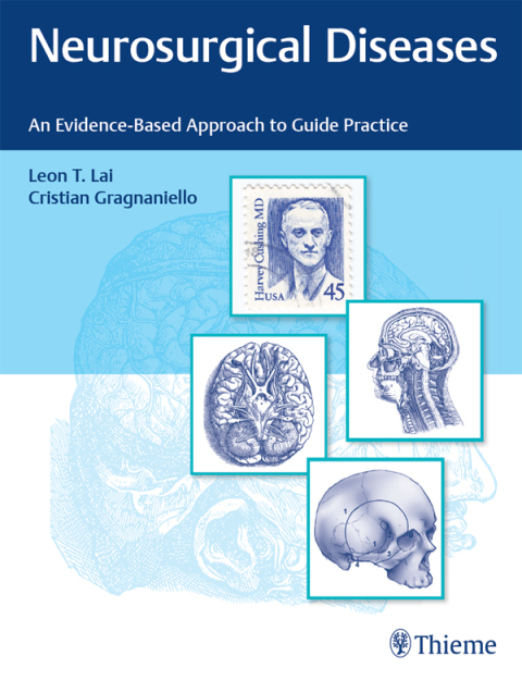 Cover image for book Neurosurgical Diseases
