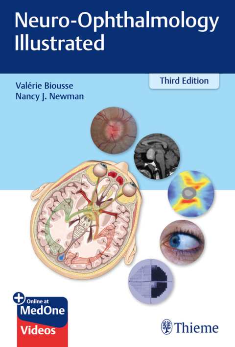 Cover image for book Neuro-Ophthalmology Illustrated