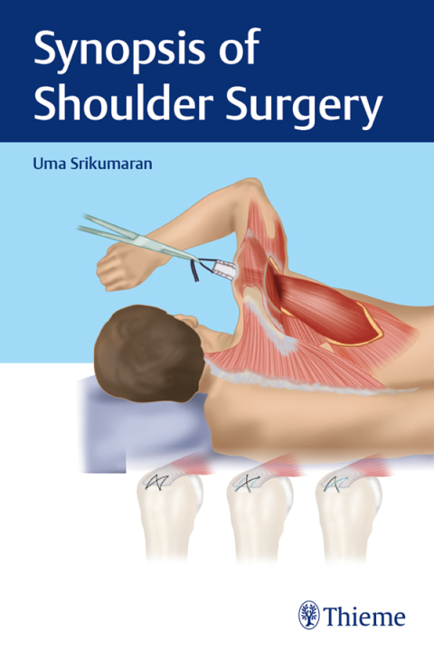 Cover image for book Synopsis of Shoulder Surgery