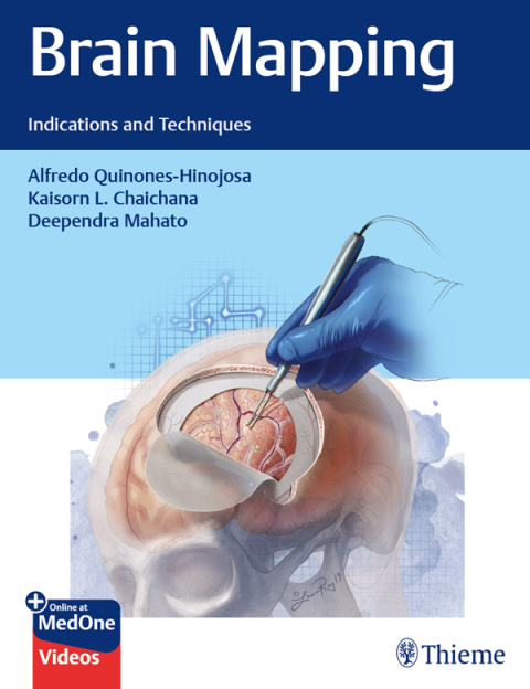 Cover image for book Brain Mapping