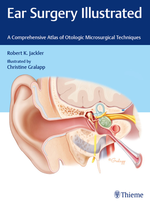 Cover image for book Ear Surgery Illustrated