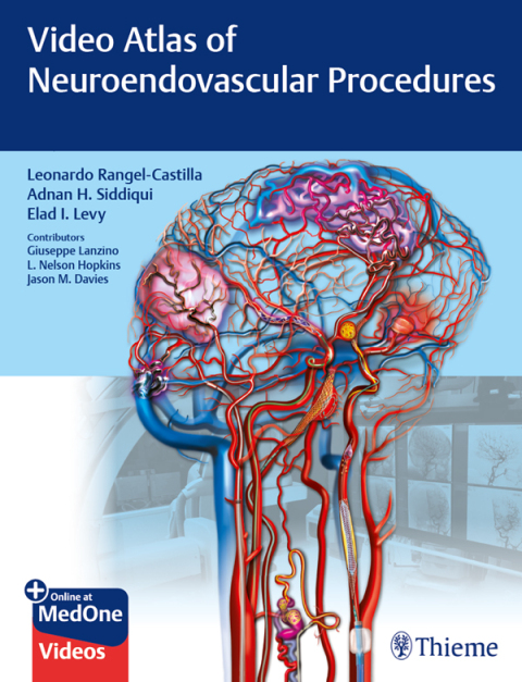 Video Atlas of Neuroendovascular Procedures 