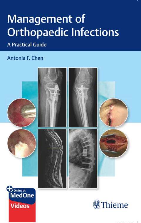 Cover image for book Management of Orthopaedic Infections