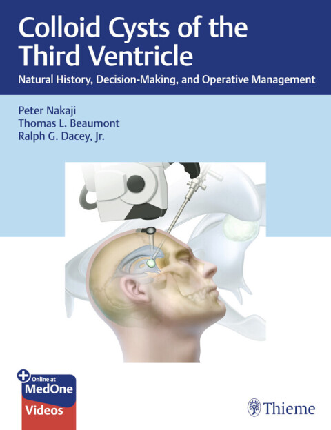 Cover image for book Colloid Cysts of the Third Ventricle