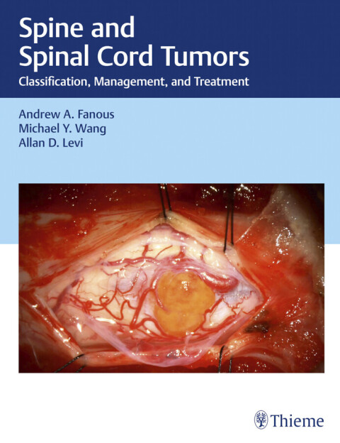 Spine and Spinal Cord Tumors 