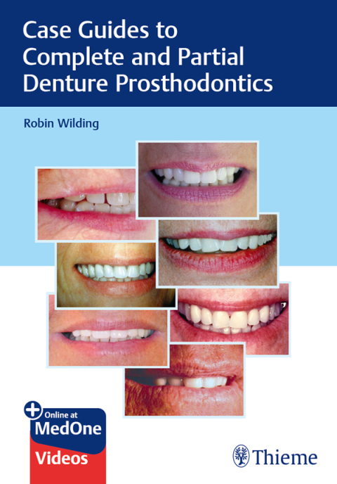 Cover image for book Case Guides to Complete and Partial Denture Prosthodontics