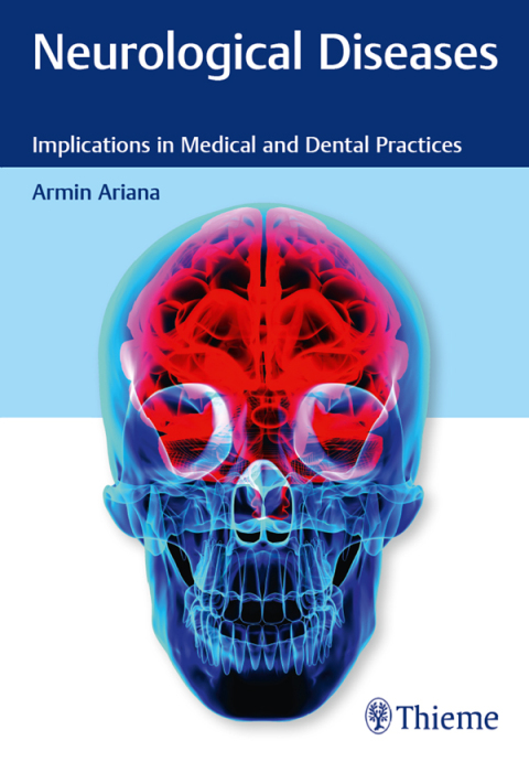 Cover image for book Neurological Diseases