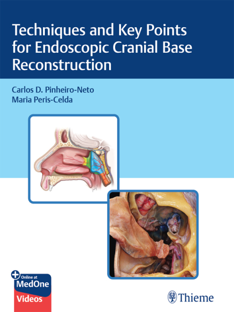 Cover image for book Techniques and Key Points for Endoscopic Cranial Base Reconstruction