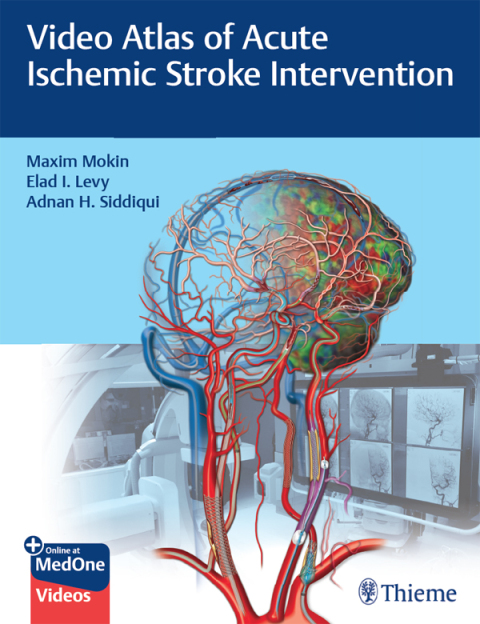 Cover image for book Video Atlas of Acute Ischemic Stroke Intervention
