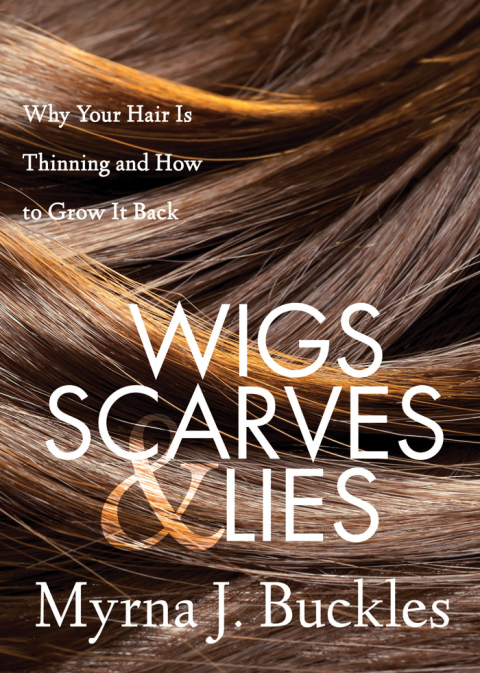 Cover image for book Wigs, Scarves & Lies