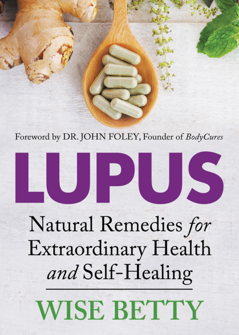 Cover image for book Lupus