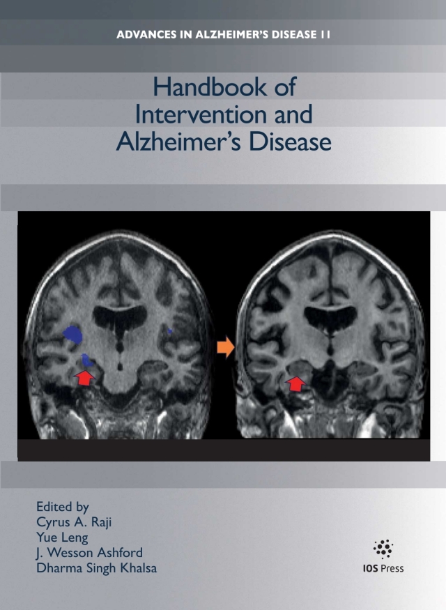 Handbook of Intervention and Alzheimer’s Disease
