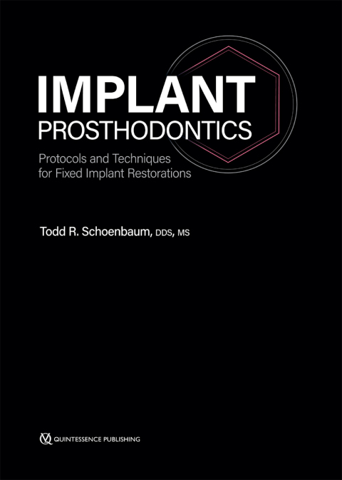 Cover image for book Implant Prosthodontics:Protocols and Techniques for Fixed Implant Restorations