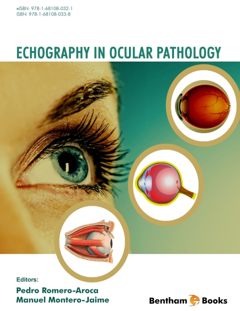 Cover image for book Echography in Ocular Pathology