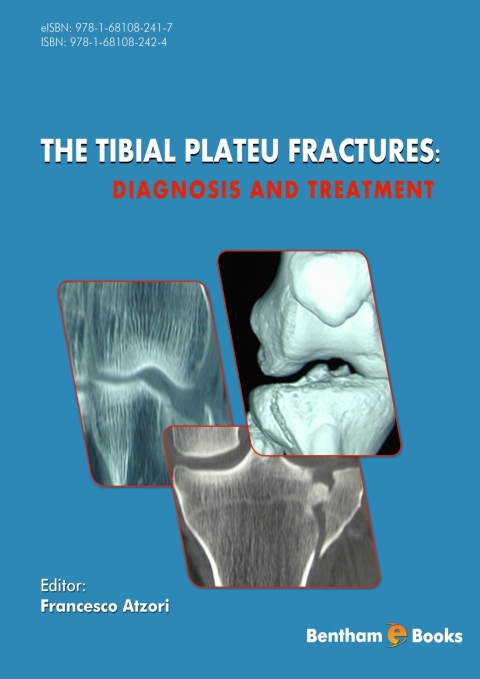 Cover image for book The Tibial Plateau Fractures: Diagnosis and Treatment
