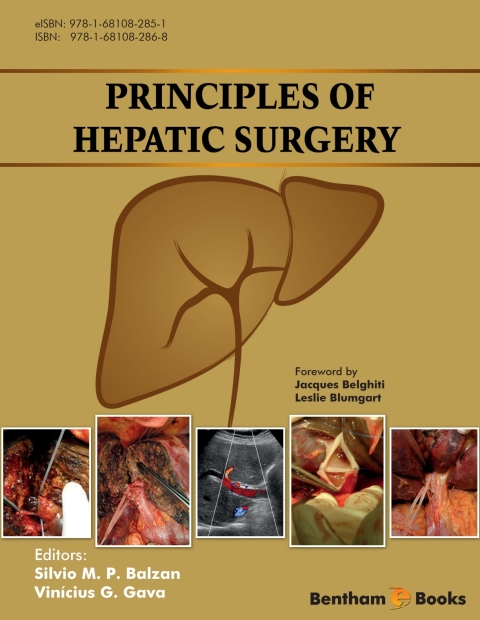 Cover image for book Principles of Hepatic Surgery