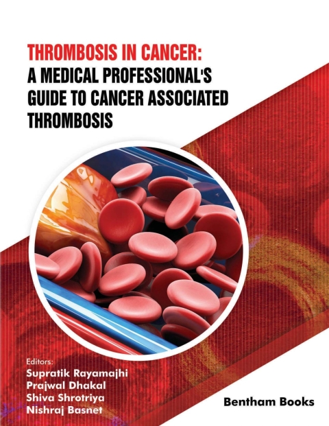 Cover image for book Thrombosis in Cancer: A Medical Professional's Guide to Cancer Associated Thrombosis