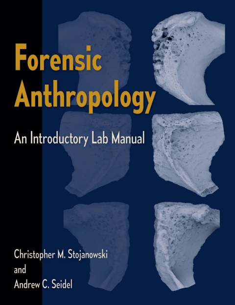 Cover image for book Forensic Anthropology