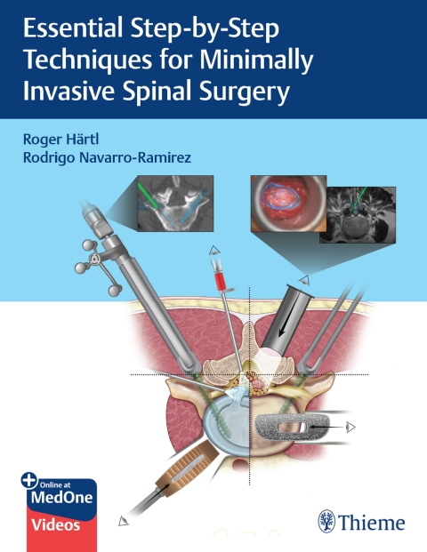 Essential Step-by-Step Techniques for Minimally Invasive Spinal Surgery 