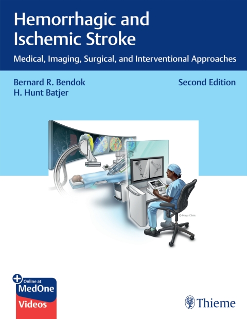 Hemorrhagic and Ischemic Stroke 