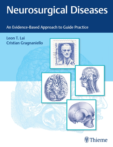 Cover image for book Neurosurgical Diseases