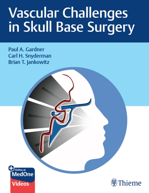 Cover image for book Vascular Challenges in Skull Base Surgery