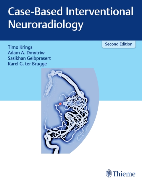 Cover image for book Case-Based Interventional Neuroradiology