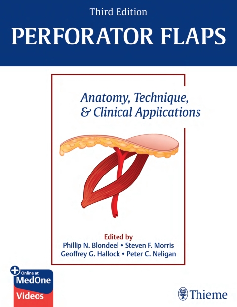 Cover image for book Perforator Flaps