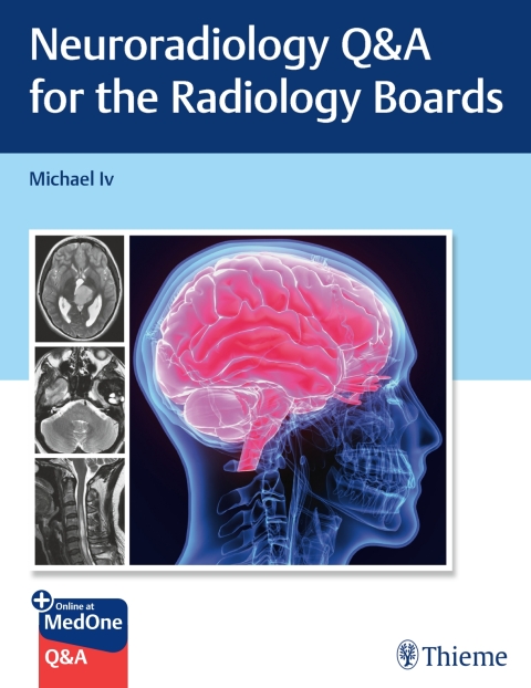 Cover image for book Neuroradiology Q&A for the Radiology Boards