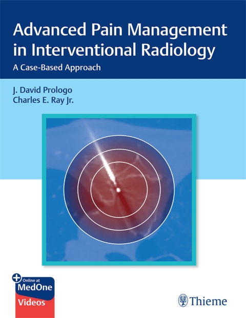 Cover image for book Advanced Pain Management in Interventional Radiology