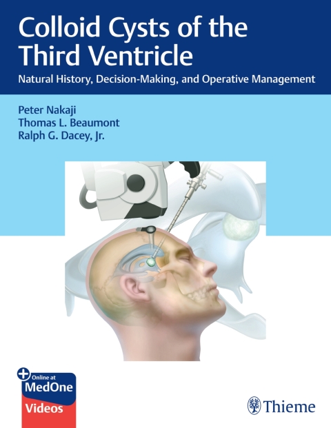 Cover image for book Colloid Cysts of the Third Ventricle