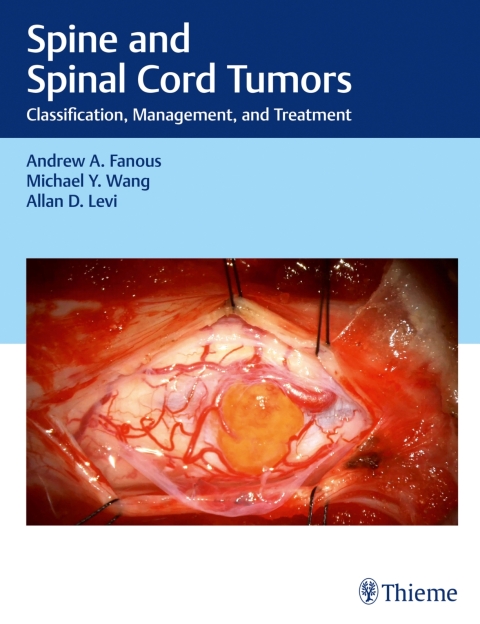 Spine and Spinal Cord Tumors 