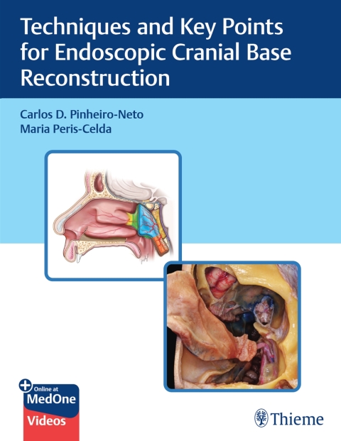 Cover image for book Techniques and Key Points for Endoscopic Cranial Base Reconstruction