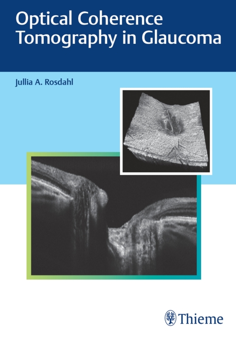 Cover image for book Optical Coherence Tomography in Glaucoma