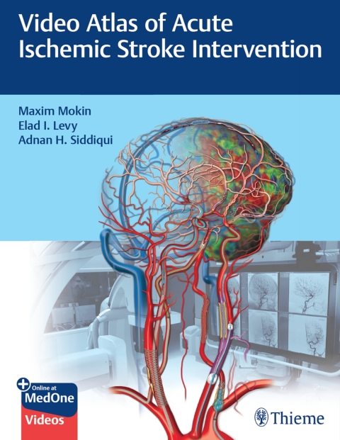 Cover image for book Video Atlas of Acute Ischemic Stroke Intervention