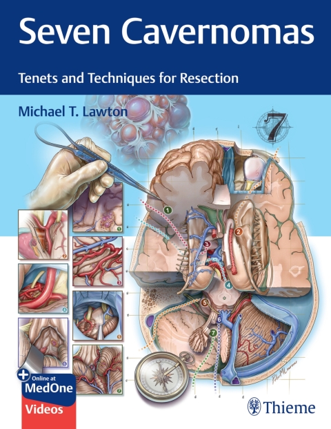 Cover image for book Seven Cavernomas